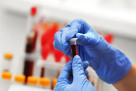 BABIO نے فلوروسینس بووائن پریگننسی ریپڈ ٹیسٹ کا آغاز کیا۔